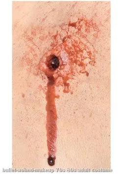 Bullet Entry And Exit Wound